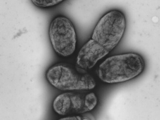 Yersinia pestis-Erreger wütete am Ende der Antike