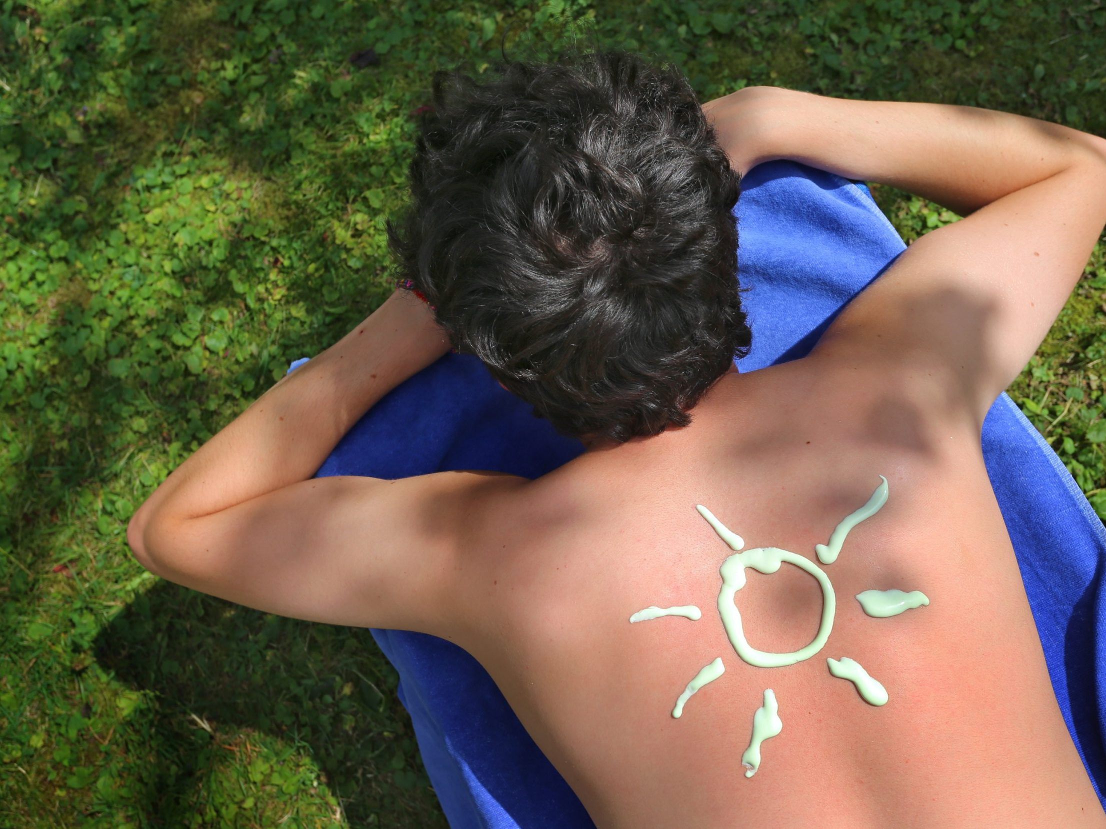 Diese Hausmittel helfen gegen Sonnenbrand. Diese Hausmittel helfen gegen Sonnenbrand.