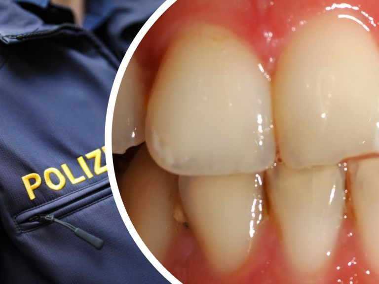 Die 31-Jährige biss einem Wiener Polizisten in die Hand. Die 31-Jährige biss einem Wiener Polizisten in die Hand.