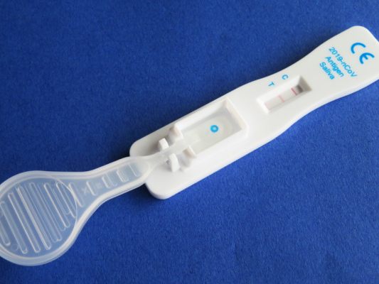 Im Verdachtsfall Test und eventuell schnelle Behandlung angeraten