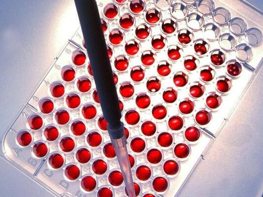 "Spop" heißt der Held