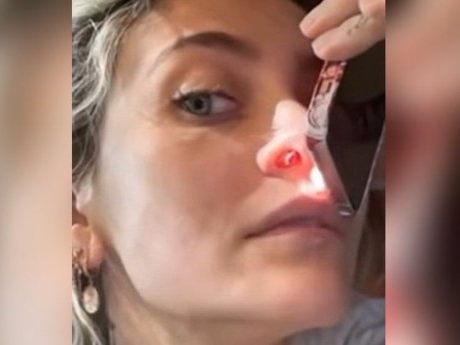 Paris Jackson zeigte auf TikTok das Loch in ihrer Nasenscheidewand, das durch ihren Drogenkonsum entstanden ist.