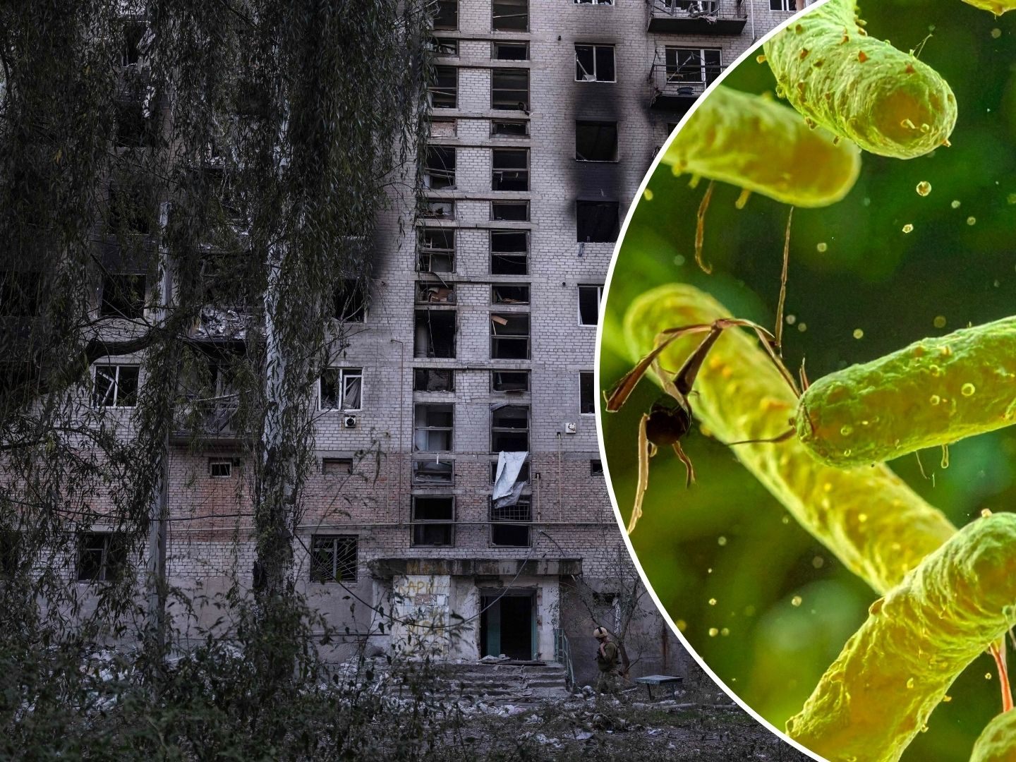 Der Ukraine-Krieg bringt eine beinahe vergessene Krankheit zurück. (SYMBOLBILD)