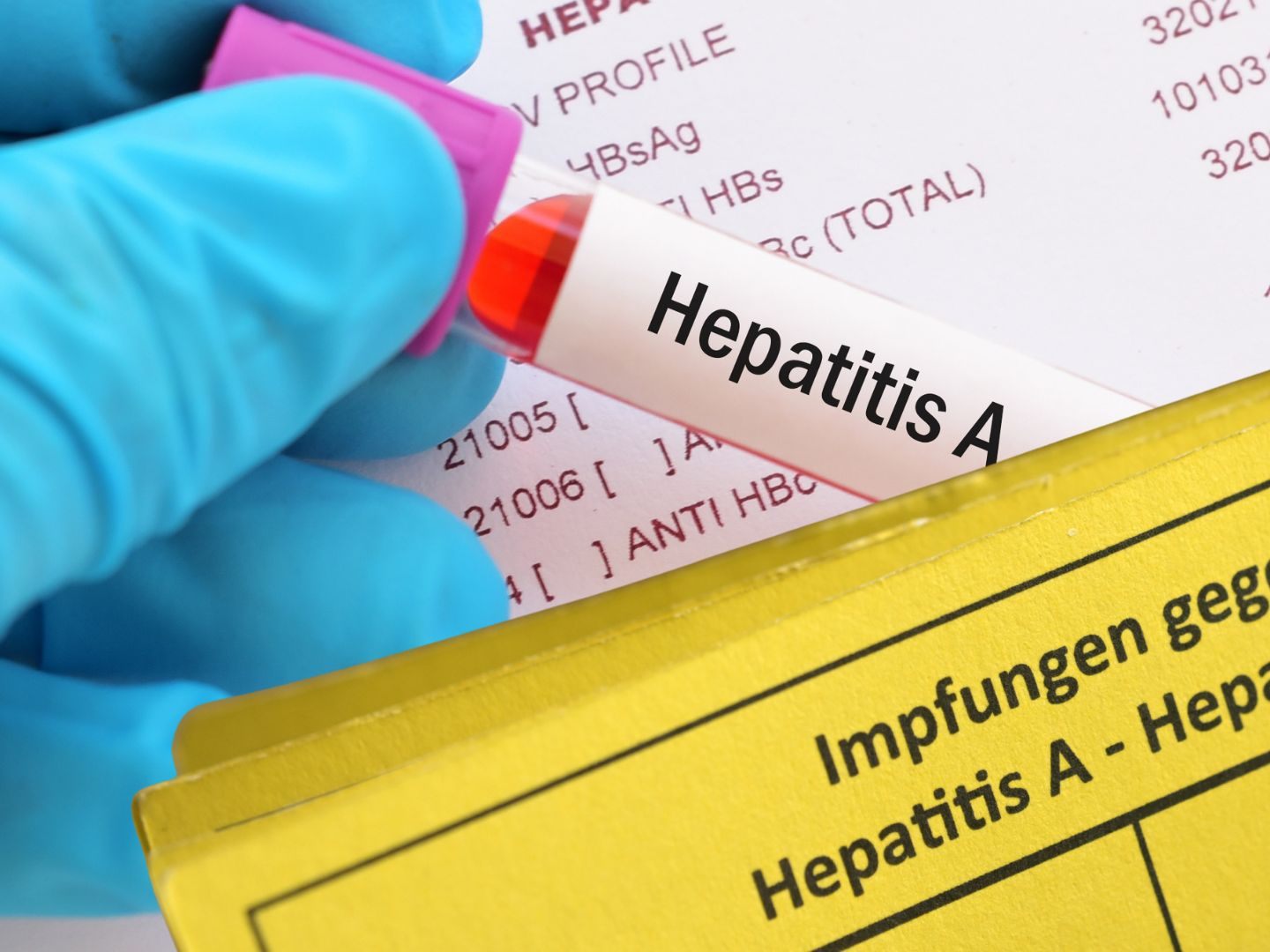 Ärztin warnt vor Impflücke bei Hepatitis A.