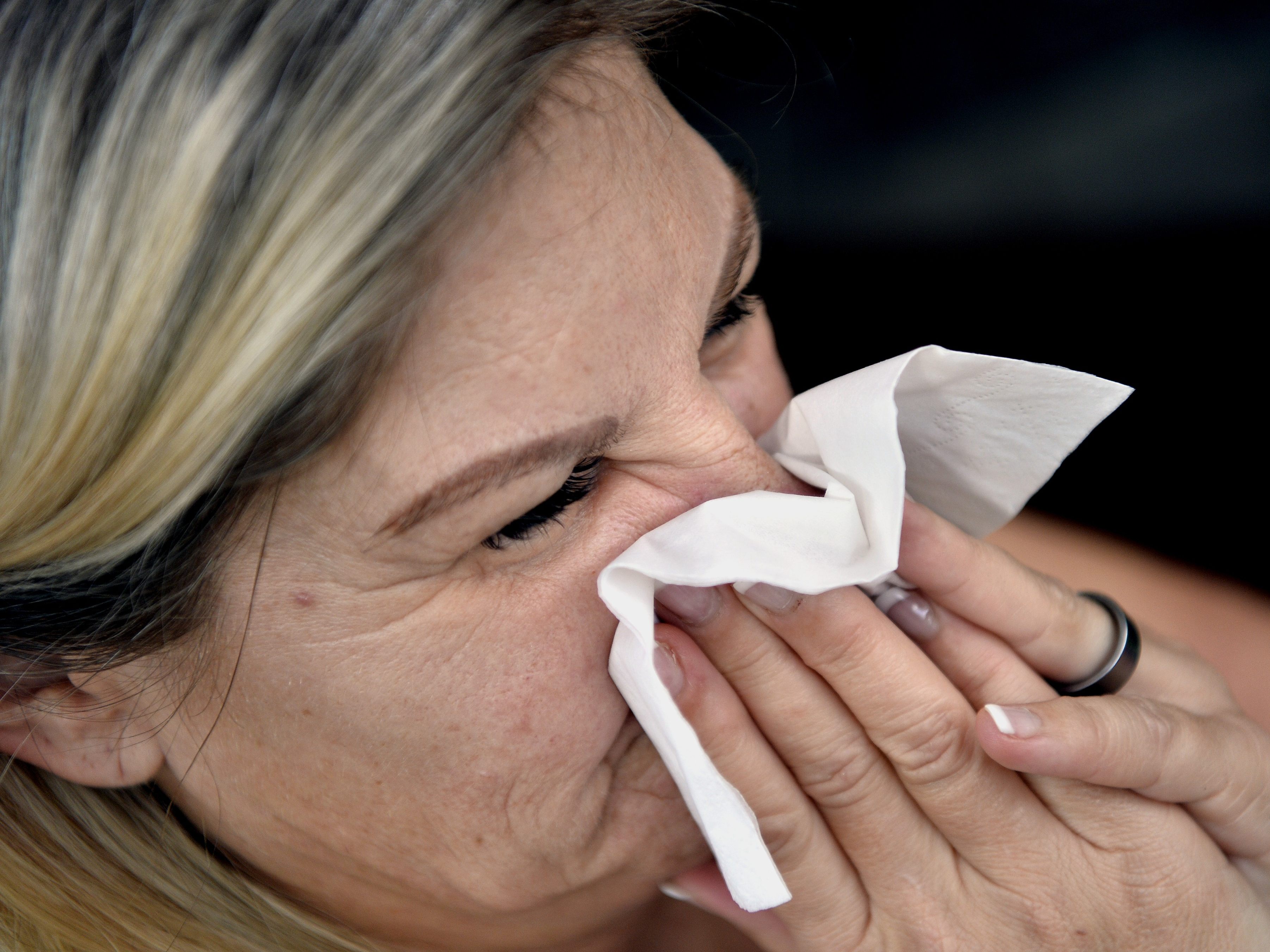 Influenza wird oft unterschätzt.