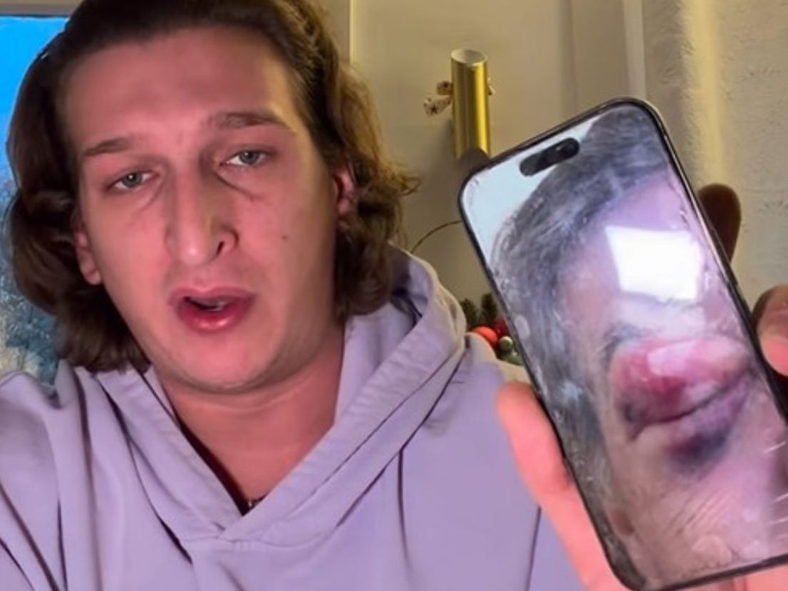 Satansbratans Vater soll von einem Schläger-Trio in Wien-Favoriten schwer verletzt worden sein.